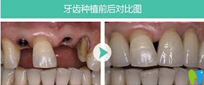 廈門瑞爾口腔門診部怎么樣 地址 電話 醫(yī)生團(tuán)隊(duì) 案例 口碑評(píng)價(jià) 開立特口腔