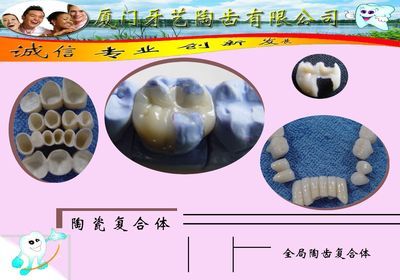 廈門牙藝陶齒-原永達